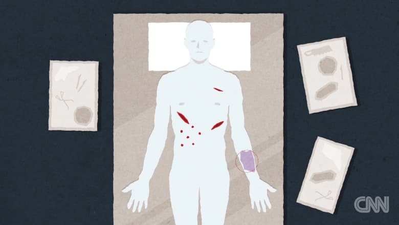 فيديو تفصيلي لما يحدث عندما يقوم الأطباء بتشريح الجثث