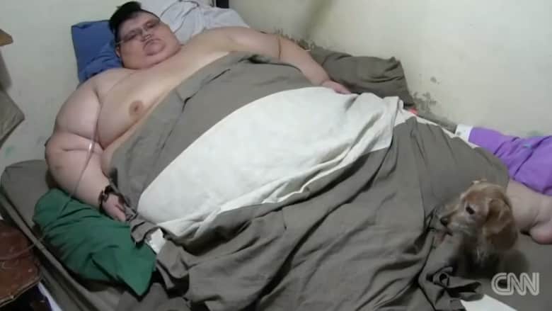 رجل يزن 500 كيلوغرام يترك سريره بعد 6 سنوات