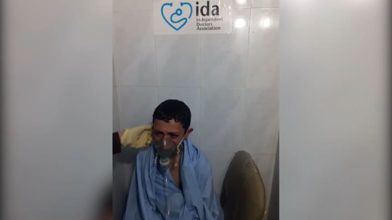 “هل سأموت؟”.. طفل سوري يعاني بعد قصف كيماوي محتمل