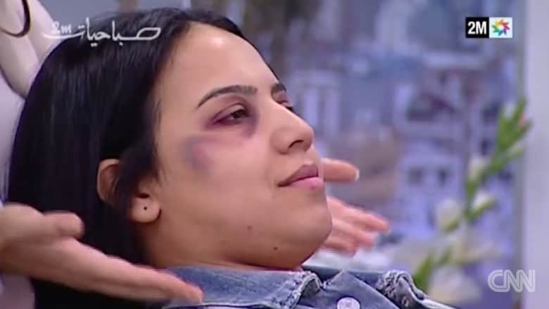 تعليم التبرج لـ"تغطية" العنف المنزلي يغضب المغاربة