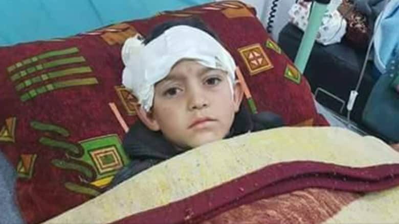 "بابا شيلني".. صرخة طفل سوري مبتور الساقين إثر القصف