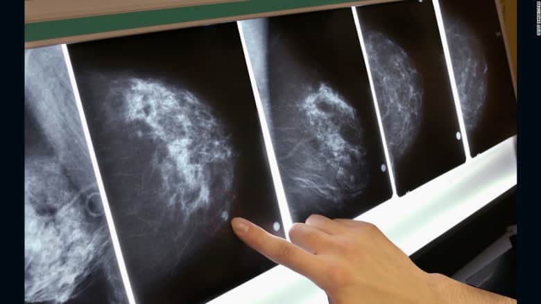 تعرف إلى أهم الحقائق حول سرطان الثدي
