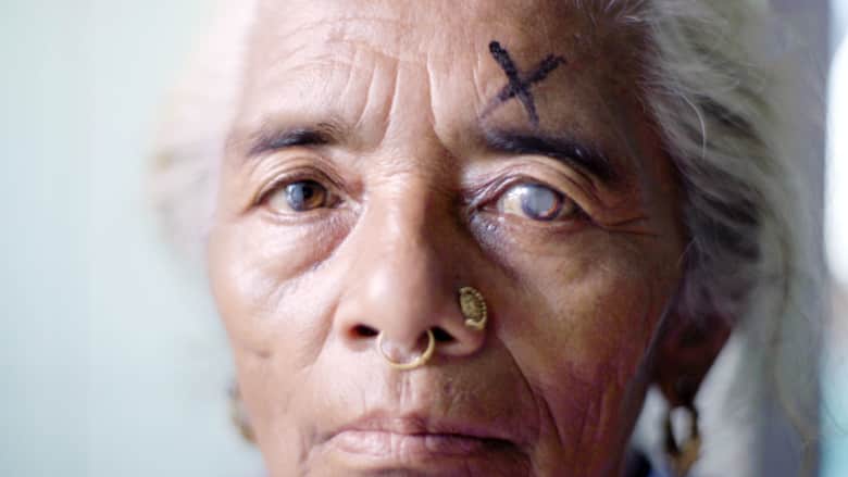 هذا الجرّاح استعاد بصر أكثر من 130 ألف مكفوف في نيبال