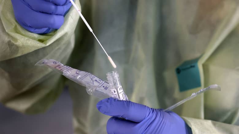 مختبرات تكافح لمجاراة الضغط على إجراء فحوصات فيروس كورونا المتراكمة