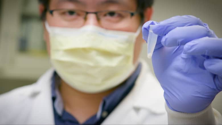علماء في جامعة بيتسبرغ يستخدمون الأجسام المضادة وحيدة النسيلة لعلاج ومنع الإصابة بفيروس كورونا