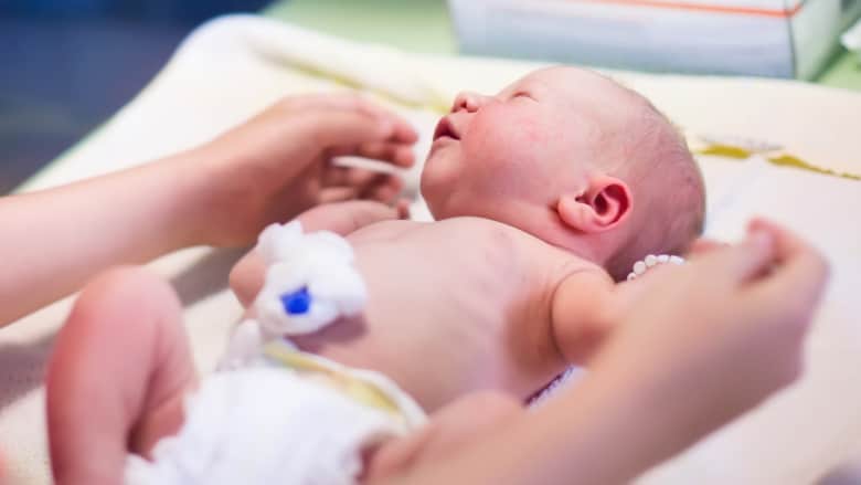 أحد الأسباب الرئيسية لوفاة آلاف الأطفال.. كيف تتجنب متلازمة موت الرضع المفاجئ؟