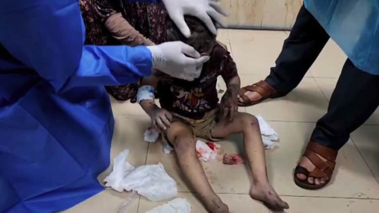 “القصف الأكثر كثافة خلال 17 يومًا”.. فيديو يُظهر الوضع المزري داخل مستشفى في غزة