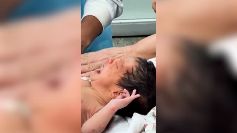 رضيع بعمر 18 يوماً ينجو بعد 32 ساعة تحت أنقاض زلزالي فنزويلا