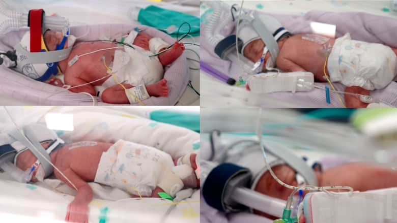 مفاجأة نادرة في أستراليا.. أم تنجب أربع توائم متطابقات من بويضة واحدة