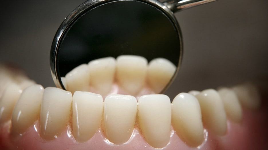 للكبار المحرجين من تقويم أسنانهم.. هل تفضلون ابتسامة بشعة وصحة ضعيفة؟