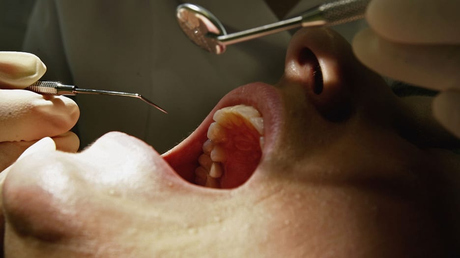 زيارة طبيب الأسنان مهمة جدا لإنقاذ حياتك