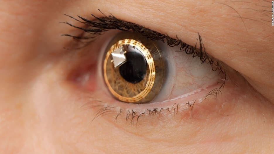 ابتكار علاج جديد قد يُنقذ 30 مليون شخص من العمى