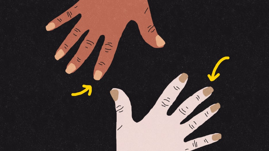 نافذة لصحة الجسم..ما سر تحول الأظافر إلى اللون الداكن؟