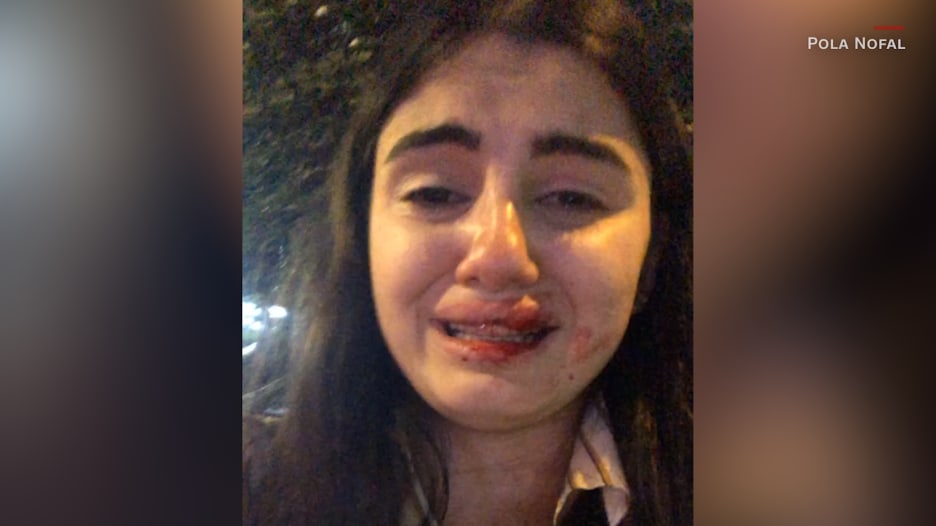 بعد فيديو "الاعتداء عليها".. بولا نوفل توضح لـCNN ما حصل