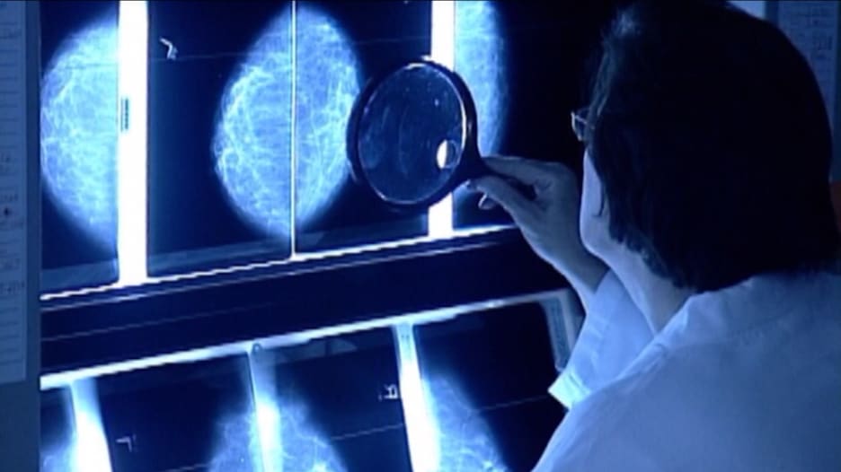 دراسة جديدة: جائحة فيروس كورونا قد تتسبب بارتفاع معدلات الإصابة بالسرطان