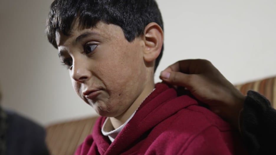 احترق جسمه وقُتل والده وشقيقه الأصغر.. هذه قصة طفل سوري بعمر الحرب السورية