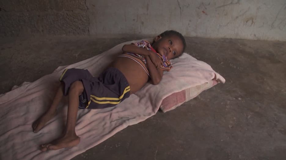 طفل يعبر عن جوعه وألمه لوالدته وما بيدها حيلة.. هذا هو اليمن