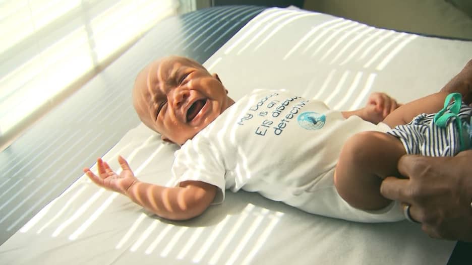 دراسة: فطام الطفل مبكراً يزيد من احتمال سمنته مستقبلاً