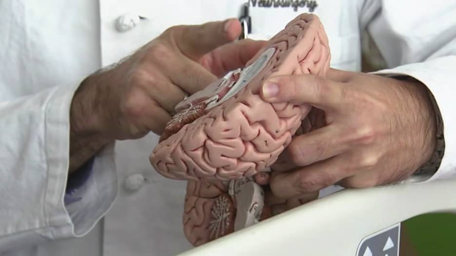 أطباء يفصلون نصف دماغ طفلة لمدى الحياة.. لعلاجها من مرض عصبي نادر