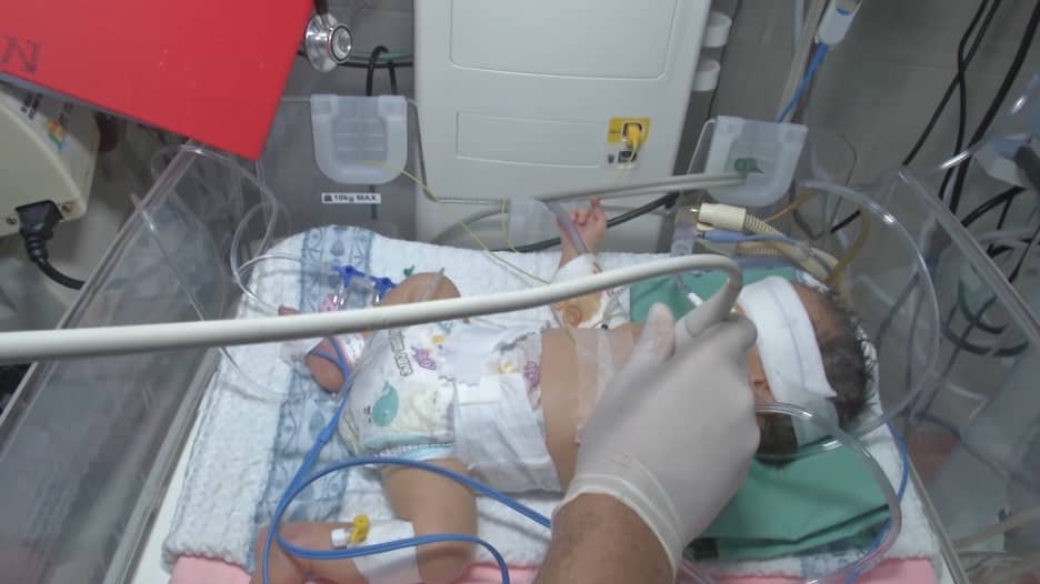 "أعتقد أننا نسمح لهم بالموت".. طبيب في غزة يصف حالة 130 من حديثي الولادة بوحدة العناية المركزة