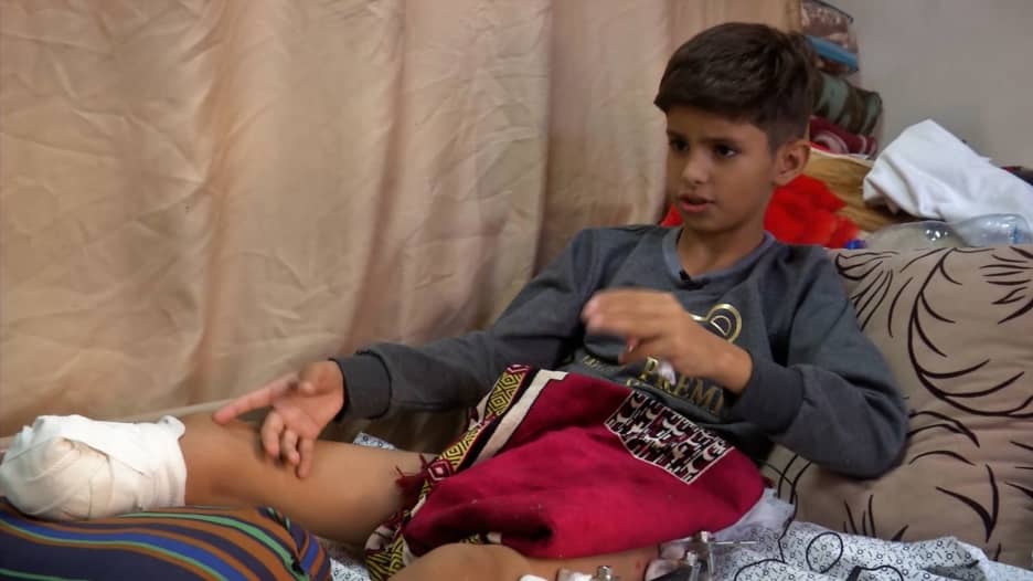 "حياتي كلها تدمرت".. أطفال يصفون أحلامهم المحطمة بعد تعرضهم لإصابات في غزة