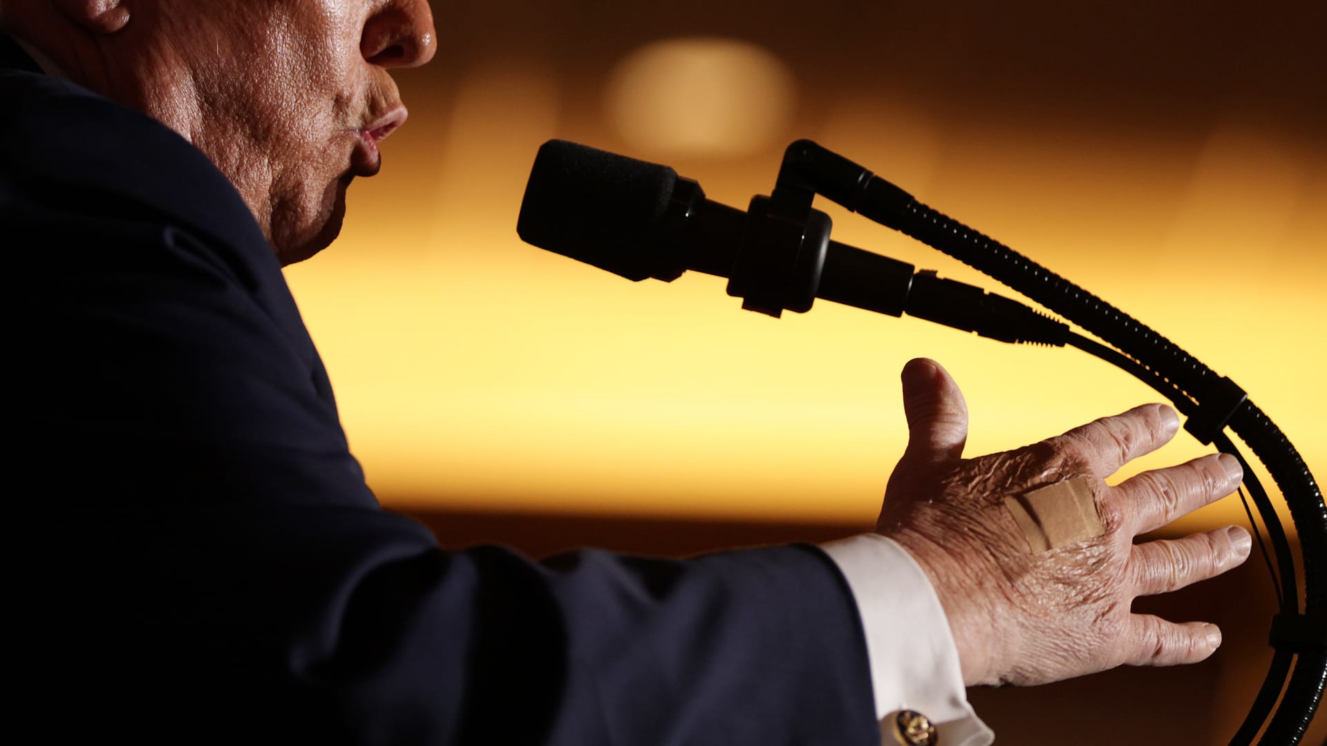 ما تفسير البيت الأبيض لوضع ترامب ضمادة على يده؟