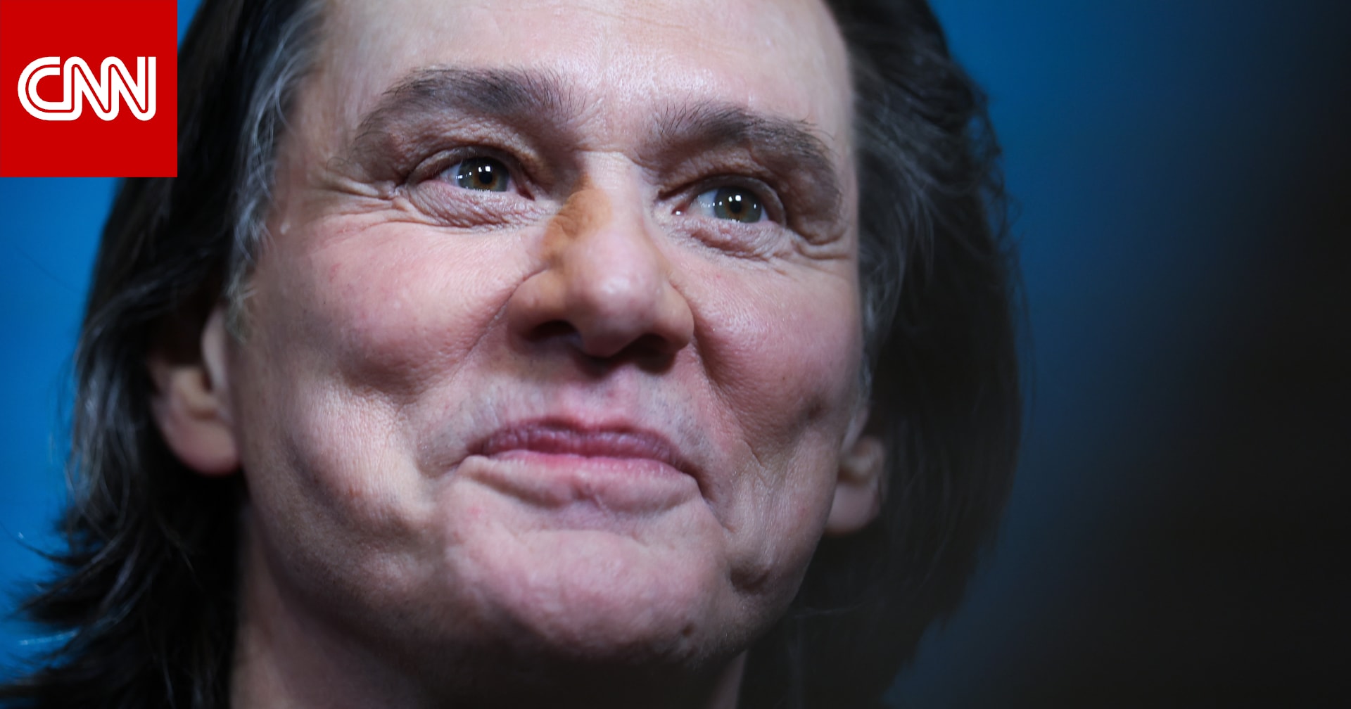 تغيّر ملامح وجه جيم كاري يثير التكهنات حول حقيقة حضوره لحفل جوائز "سيزار"