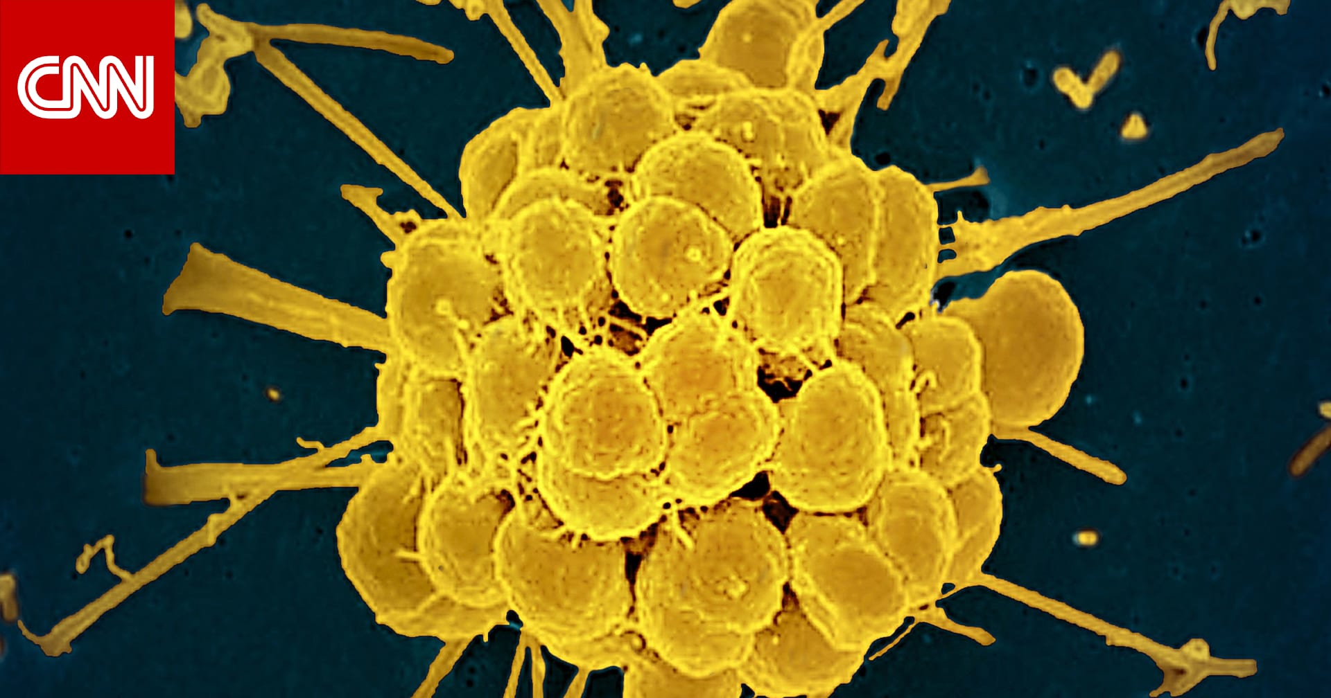 الغذاء والدواء الأمريكية توافق على مضادين حيويين جديدين لعلاج السيلان منذ عقود 