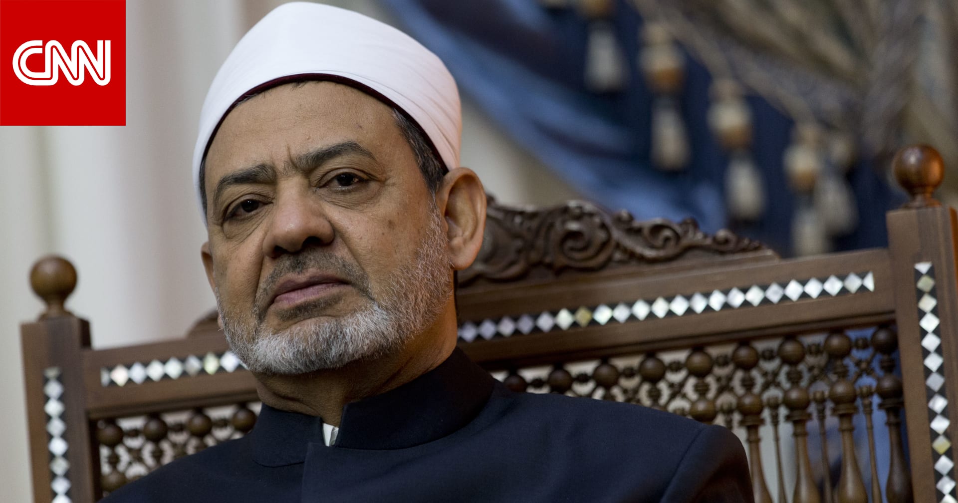تحدث الحروق بسبب الغفلة وسوء التصرف أو الأهمال
