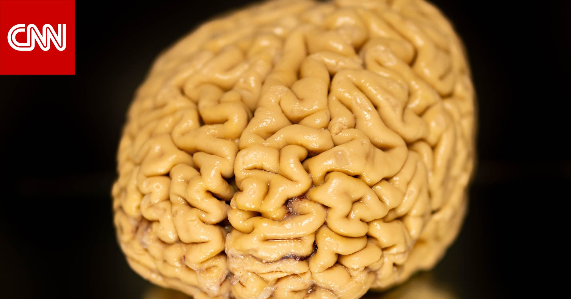 علماء يكتشفون مفتاح الحفاظ على حدة الذهن في الشيخوخة 